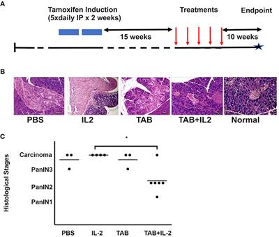 Combining the Specific Anti-MUC1 Antibody TAB004 and Lip-MSA-IL-2 Limits Pancreatic Cancer Progression in Immune Competent Murine Models of Pancreatic Ductal Adenocarcinoma